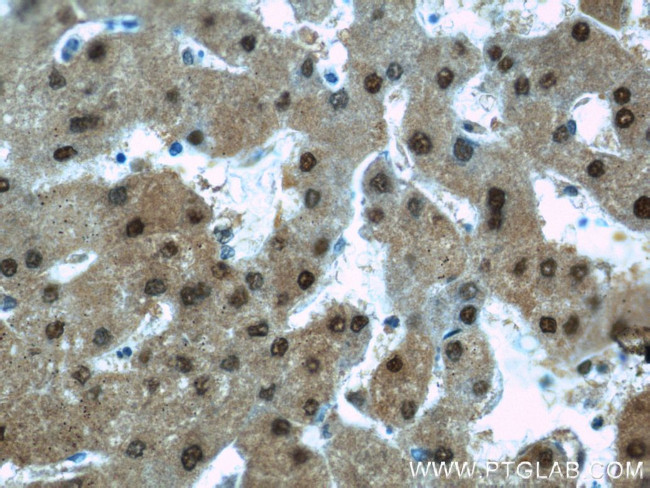 PSMB5 Antibody in Immunohistochemistry (Paraffin) (IHC (P))