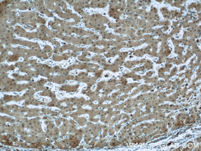 PSMB5 Antibody in Immunohistochemistry (Paraffin) (IHC (P))