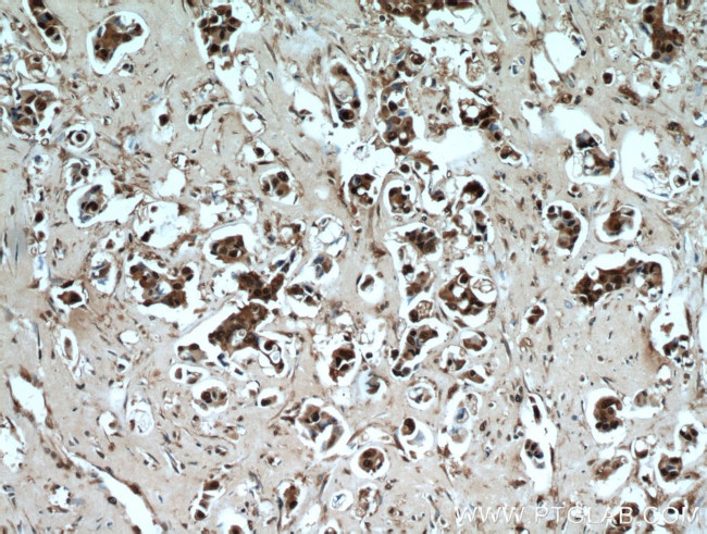 PSMB5 Antibody in Immunohistochemistry (Paraffin) (IHC (P))