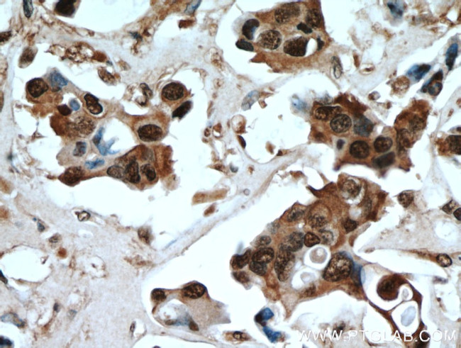 PSMB5 Antibody in Immunohistochemistry (Paraffin) (IHC (P))