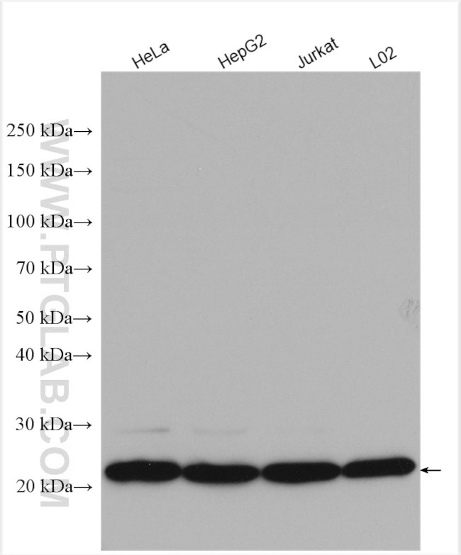 PSMB5 Antibody in Western Blot (WB)