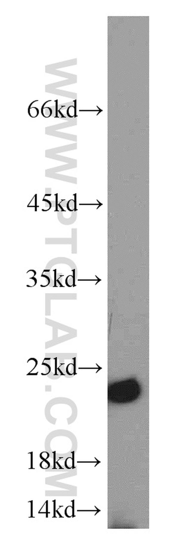 PSMB5 Antibody in Western Blot (WB)