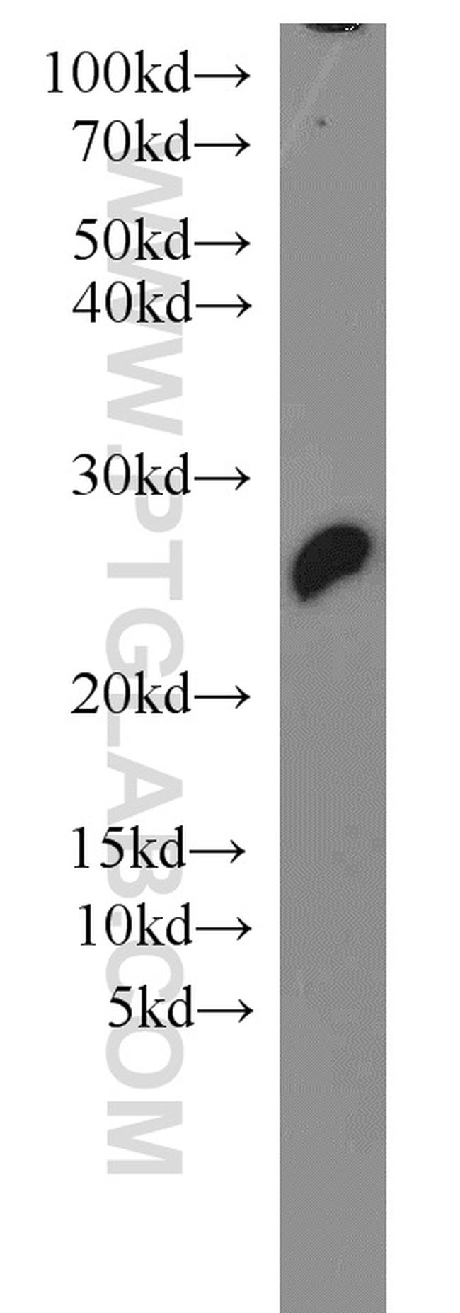 PSMB5 Antibody in Western Blot (WB)