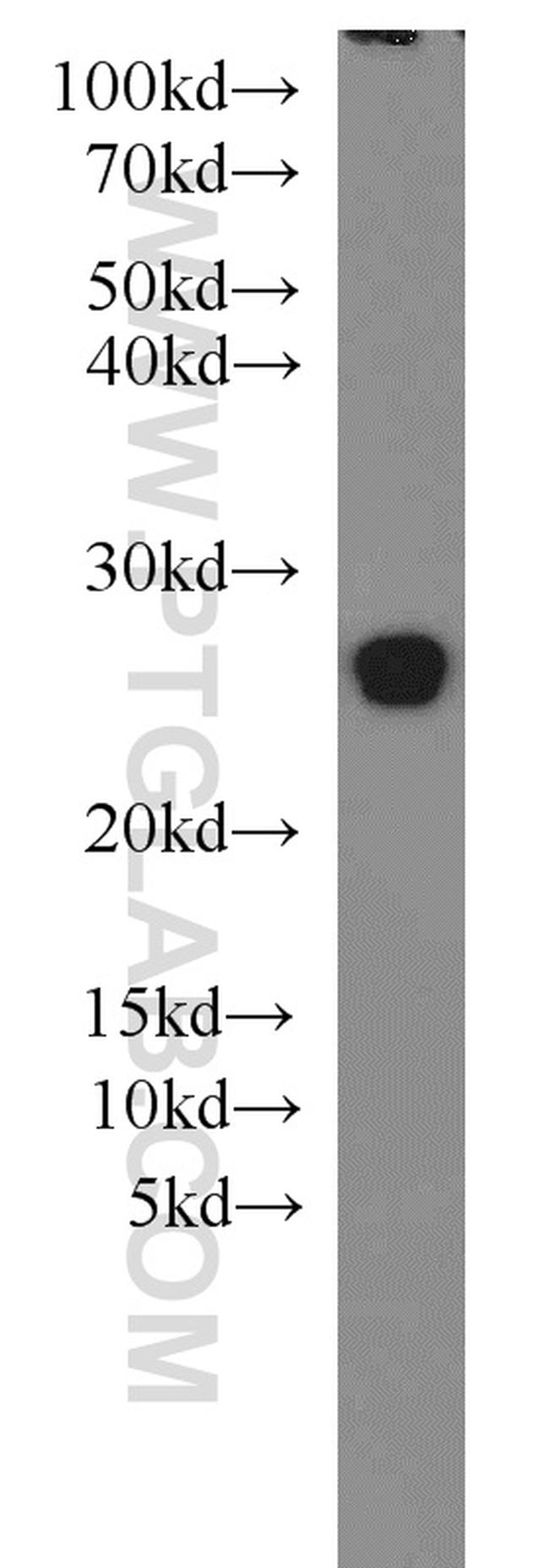 PSMB5 Antibody in Western Blot (WB)