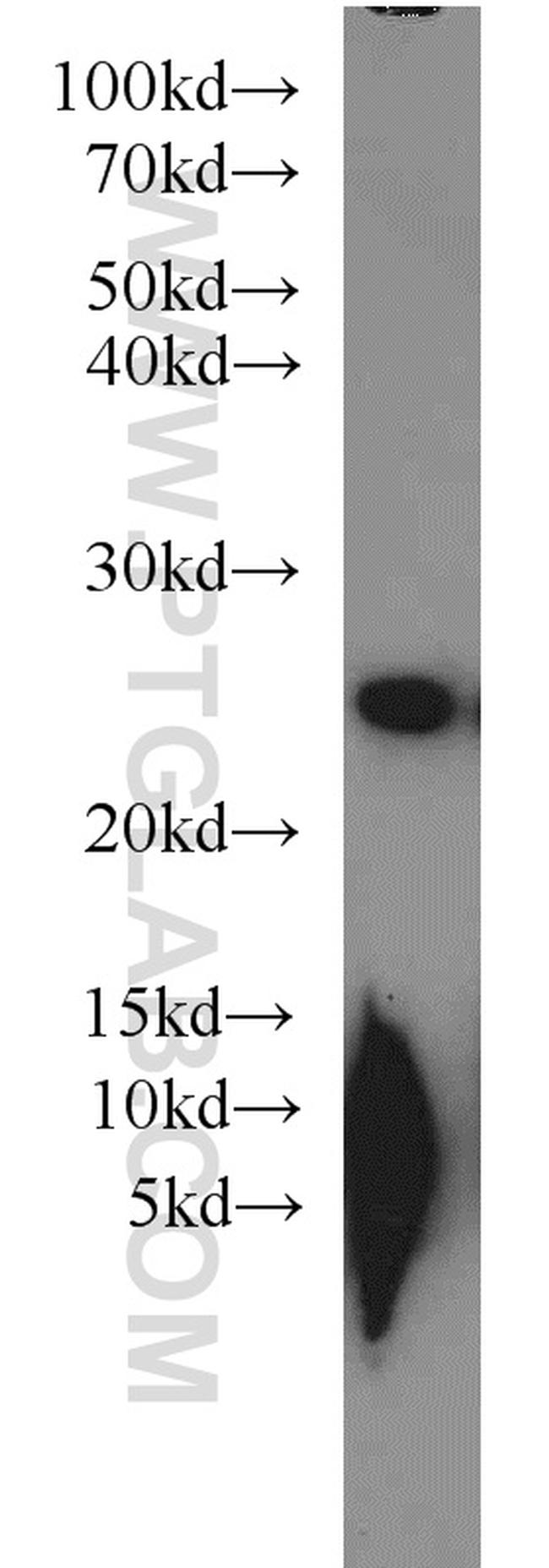 PSMB5 Antibody in Western Blot (WB)