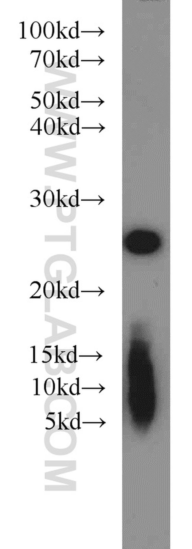 PSMB5 Antibody in Western Blot (WB)