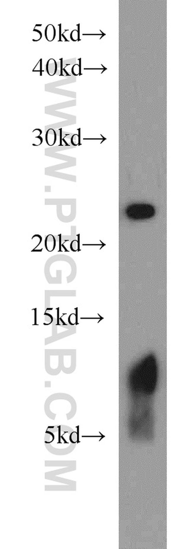 PSMB5 Antibody in Western Blot (WB)