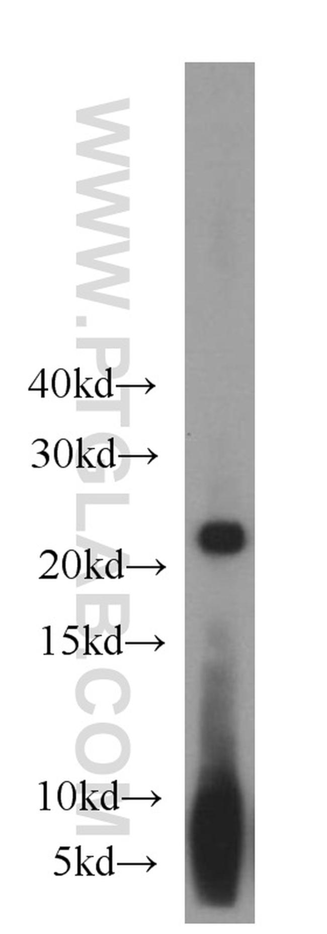 PSMB5 Antibody in Western Blot (WB)