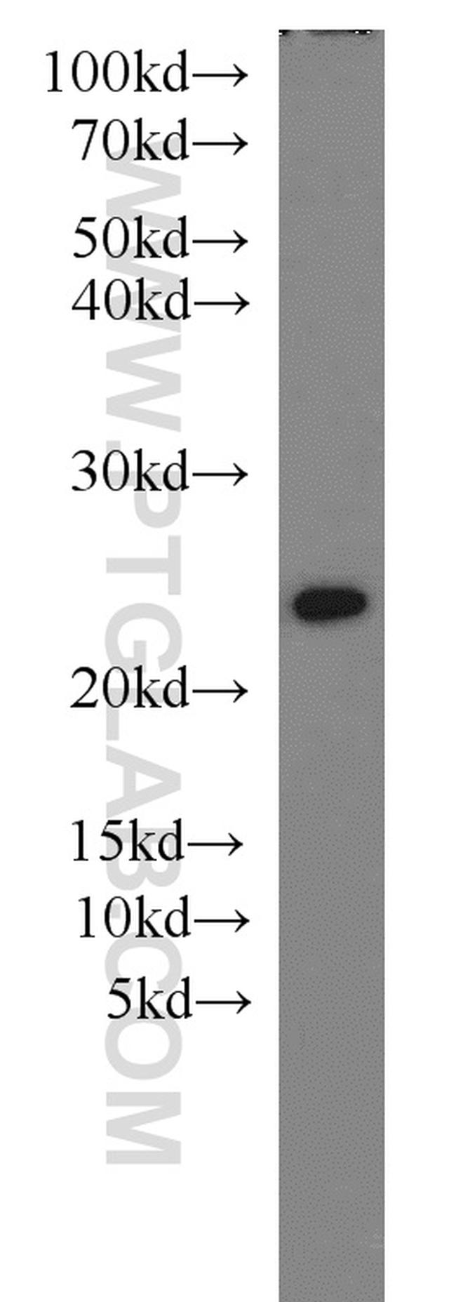 PSMB5 Antibody in Western Blot (WB)