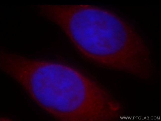 NAT1 Antibody in Immunocytochemistry (ICC/IF)