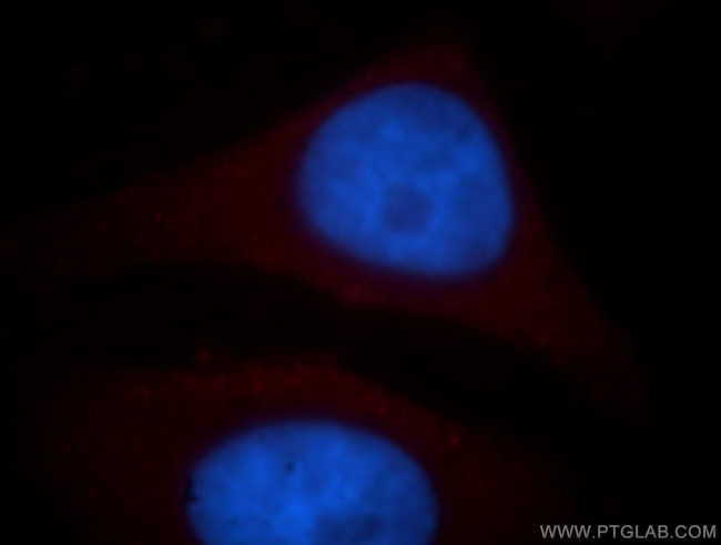 NAT1 Antibody in Immunocytochemistry (ICC/IF)