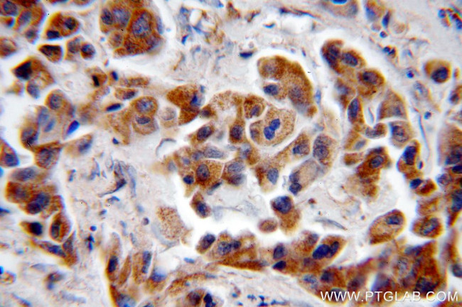 NAT1 Antibody in Immunohistochemistry (Paraffin) (IHC (P))