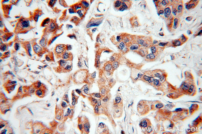 NAT1 Antibody in Immunohistochemistry (Paraffin) (IHC (P))