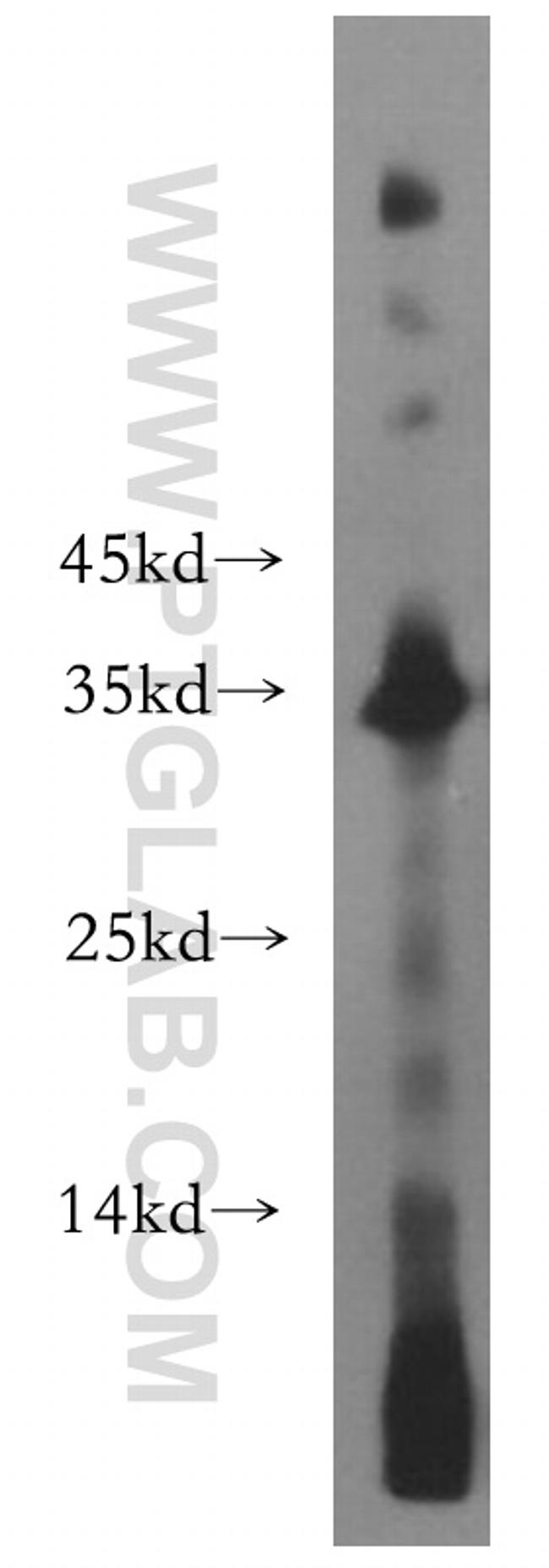 NAT1 Antibody in Western Blot (WB)