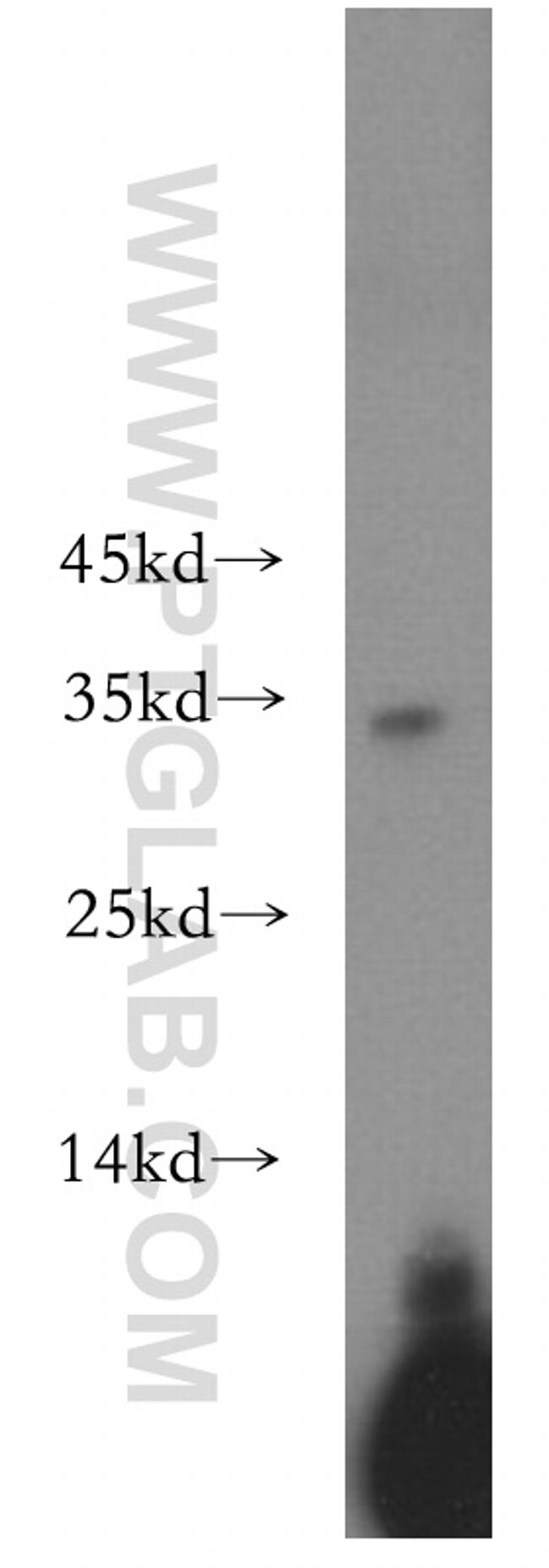 NAT1 Antibody in Western Blot (WB)