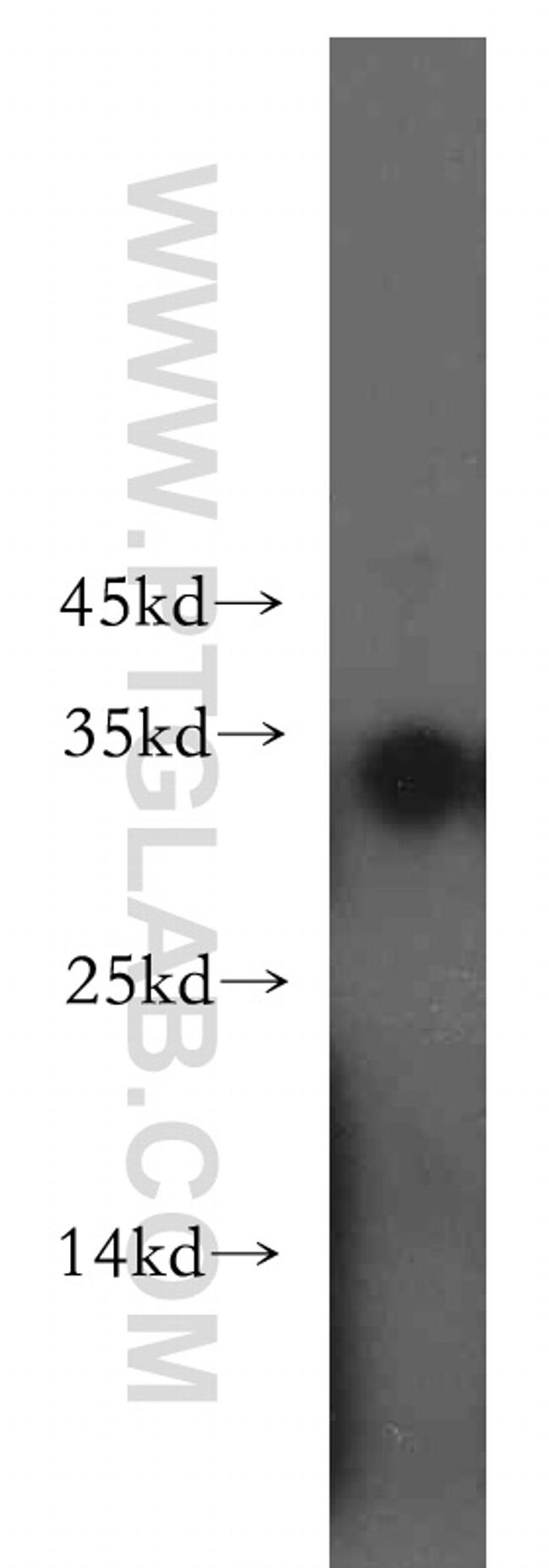 NAT1 Antibody in Western Blot (WB)