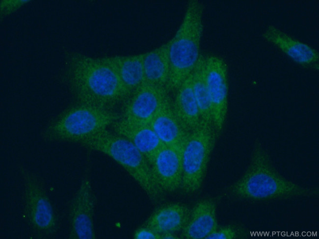 WDR45 Antibody in Immunocytochemistry (ICC/IF)