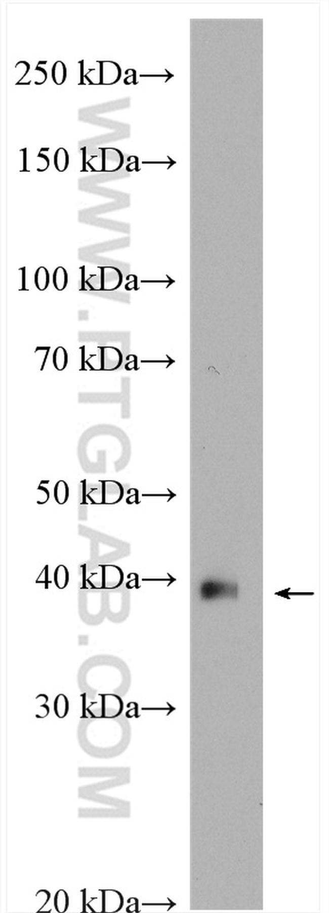 WDR45 Antibody in Western Blot (WB)