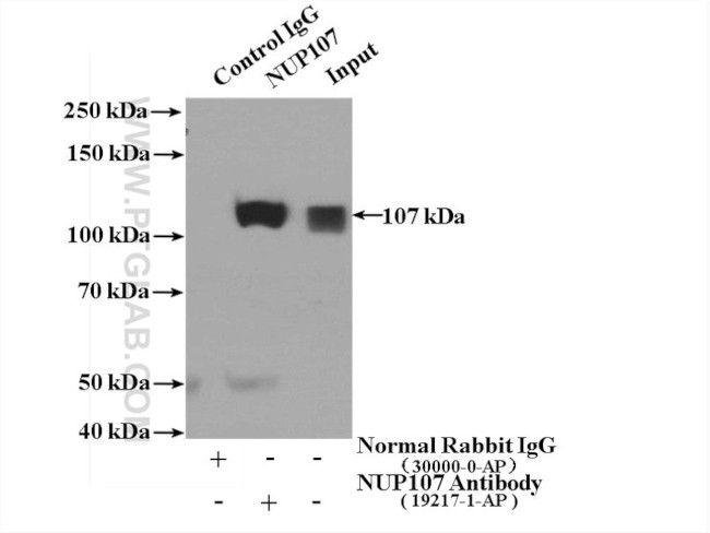 NUP107 Antibody in Immunoprecipitation (IP)
