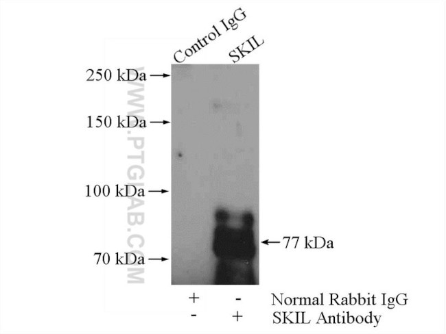 SKIL Antibody in Immunoprecipitation (IP)