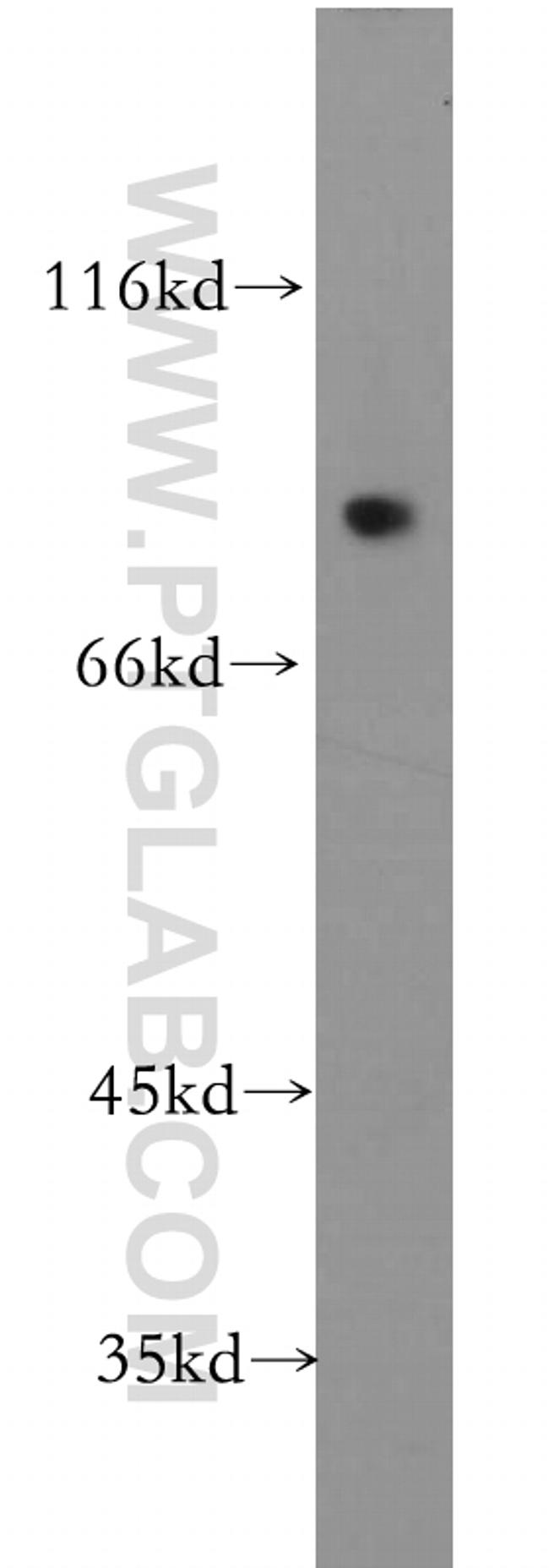 SKIL Antibody in Western Blot (WB)