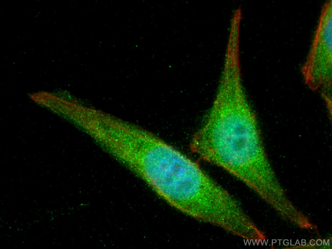 SKIL Antibody in Immunocytochemistry (ICC/IF)