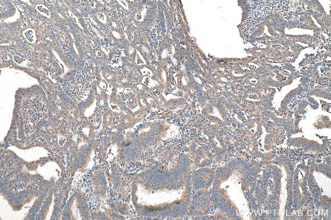 SKIL Antibody in Immunohistochemistry (Paraffin) (IHC (P))