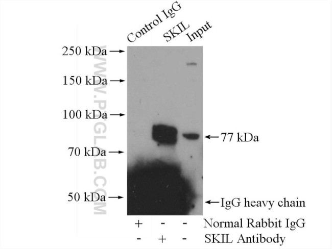 SKIL Antibody in Immunoprecipitation (IP)