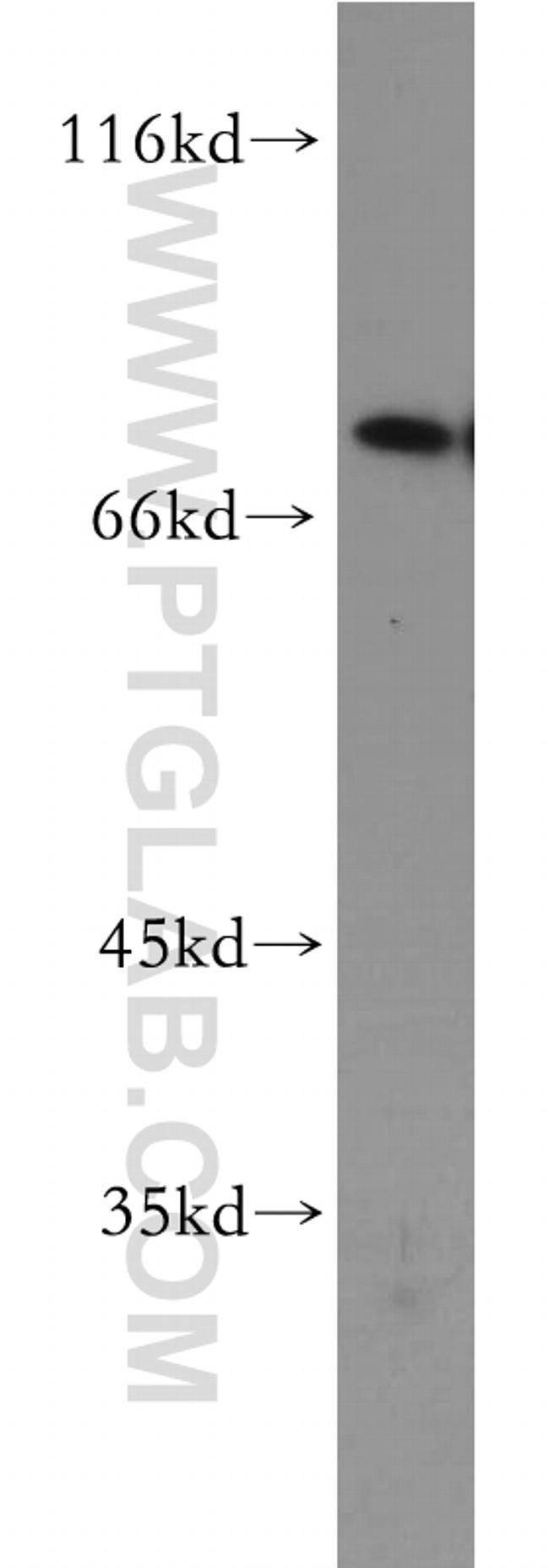 SKIL Antibody in Western Blot (WB)