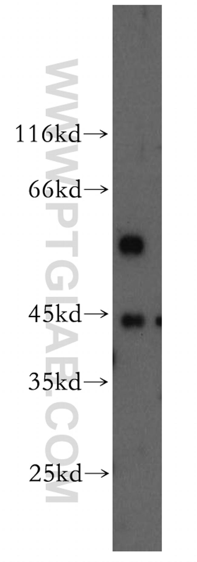 DNMT2 Antibody in Western Blot (WB)