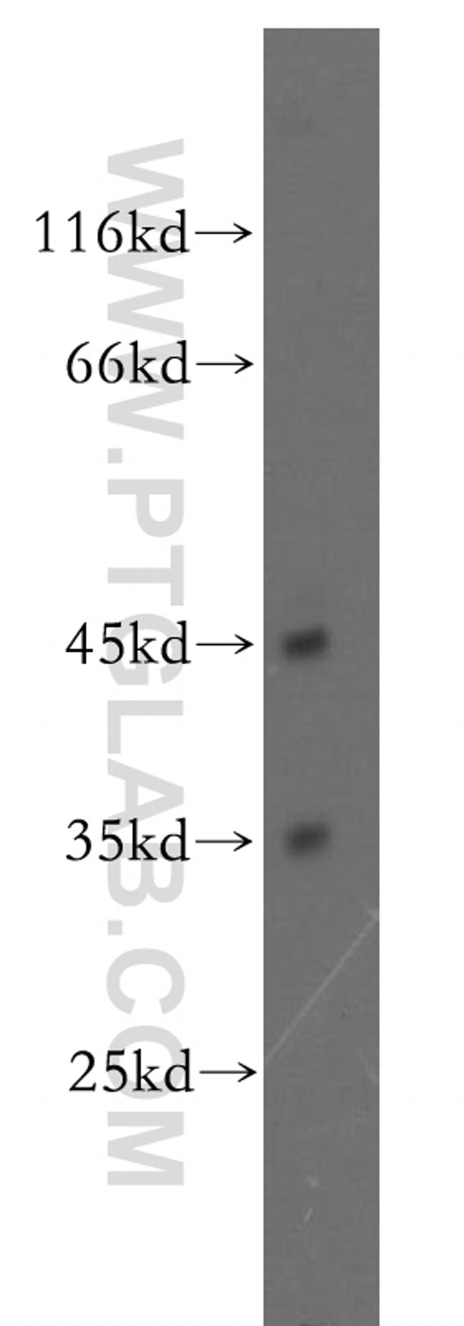 DNMT2 Antibody in Western Blot (WB)