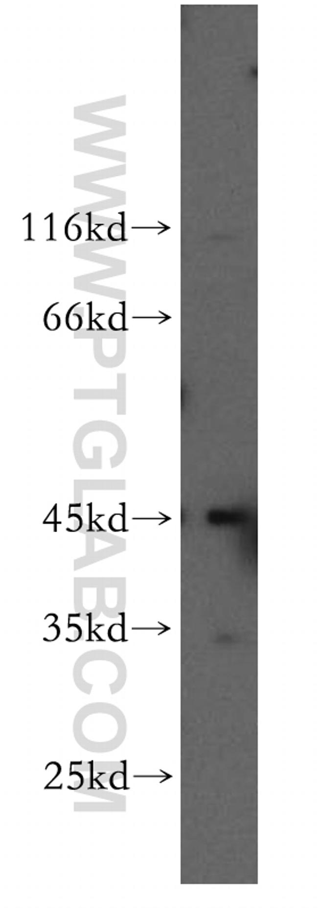 DNMT2 Antibody in Western Blot (WB)