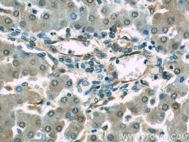 CD39/ENTPD1 Antibody in Immunohistochemistry (Paraffin) (IHC (P))