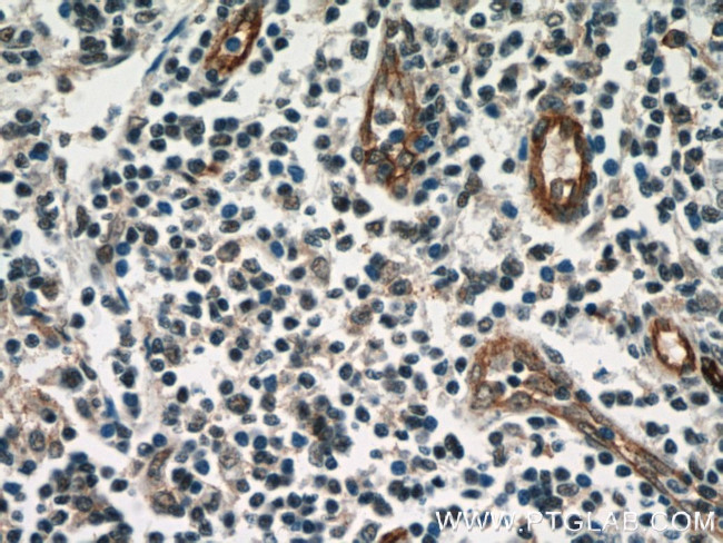 CD39/ENTPD1 Antibody in Immunohistochemistry (Paraffin) (IHC (P))