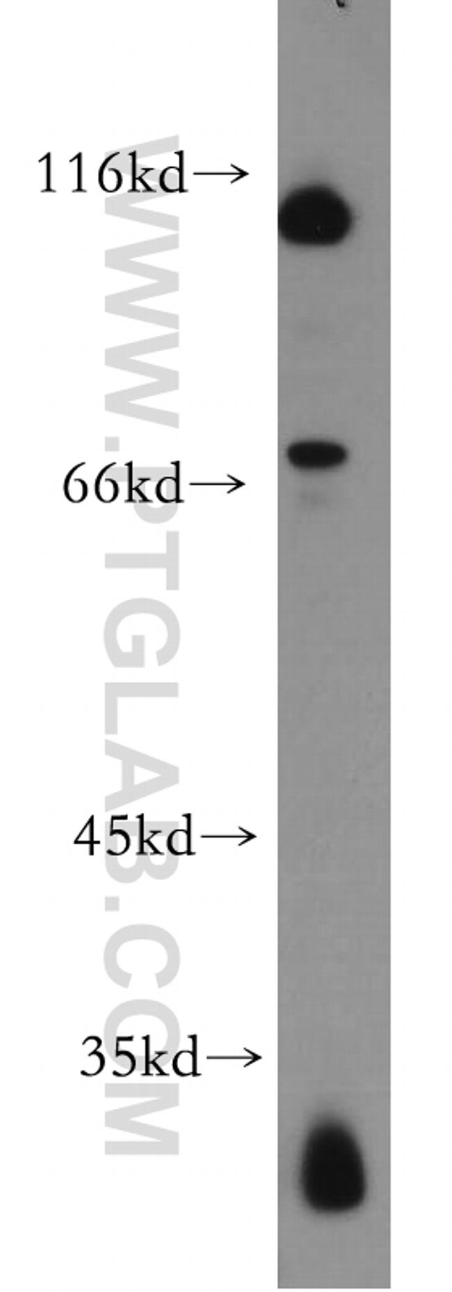 CD39/ENTPD1 Antibody in Western Blot (WB)