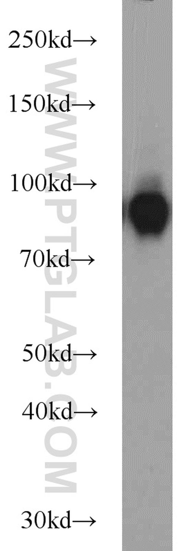 CD39/ENTPD1 Antibody in Western Blot (WB)