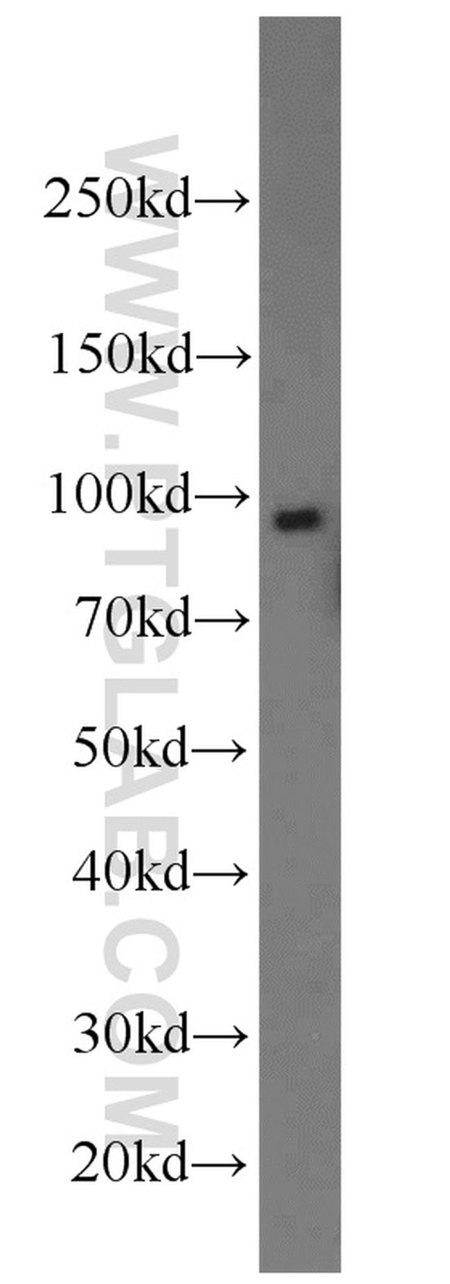 CD39/ENTPD1 Antibody in Western Blot (WB)