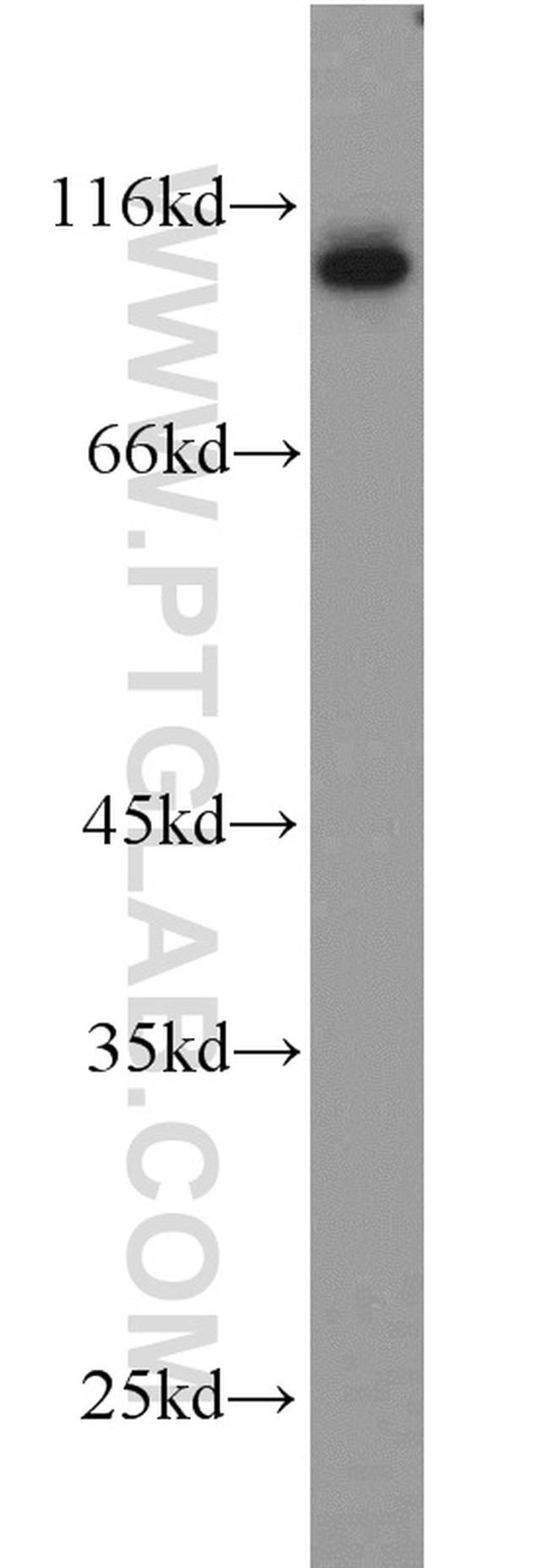 CD39/ENTPD1 Antibody in Western Blot (WB)