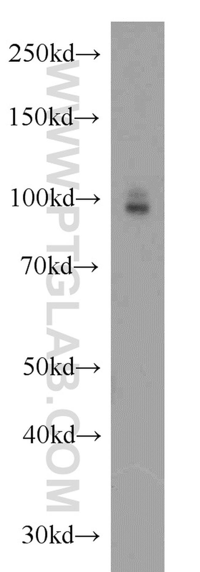 CD39/ENTPD1 Antibody in Western Blot (WB)