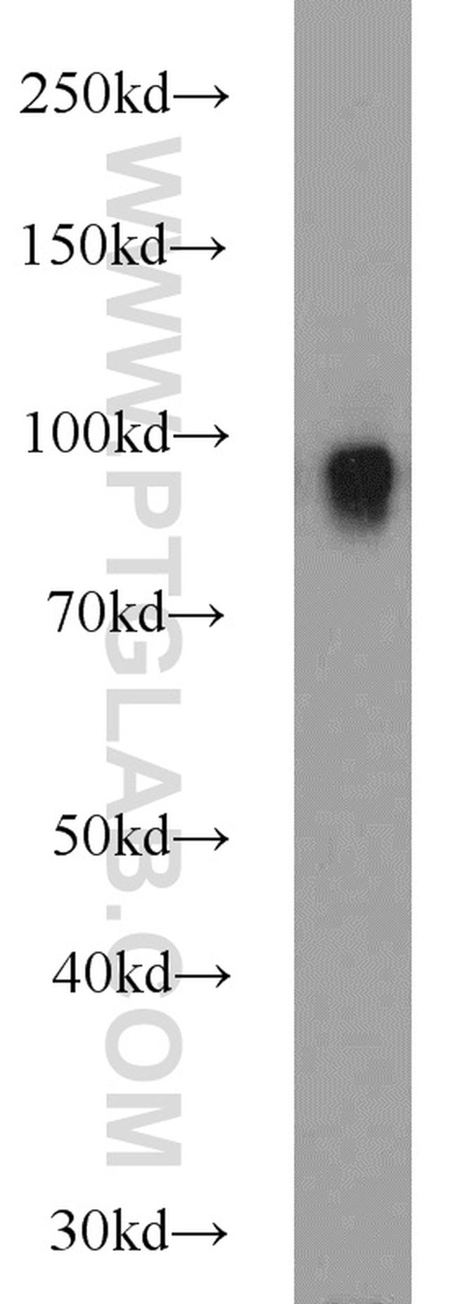 CD39/ENTPD1 Antibody in Western Blot (WB)