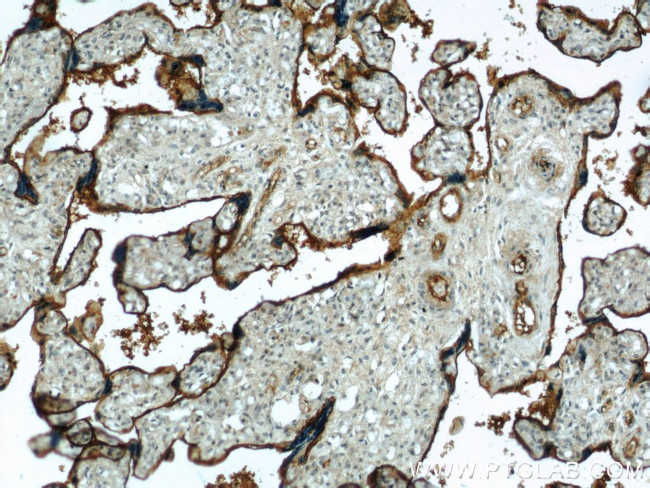 CD39/ENTPD1 Antibody in Immunohistochemistry (Paraffin) (IHC (P))