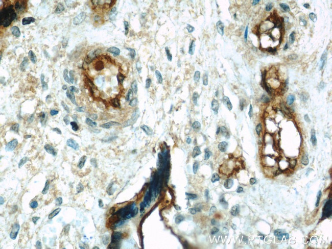 CD39/ENTPD1 Antibody in Immunohistochemistry (Paraffin) (IHC (P))