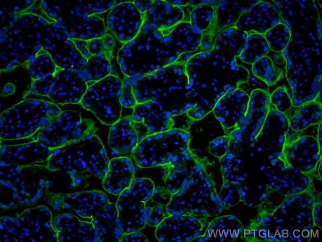 CD39/ENTPD1 Antibody in Immunohistochemistry (PFA fixed) (IHC (PFA))