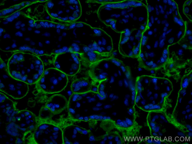 CD39/ENTPD1 Antibody in Immunohistochemistry (PFA fixed) (IHC (PFA))