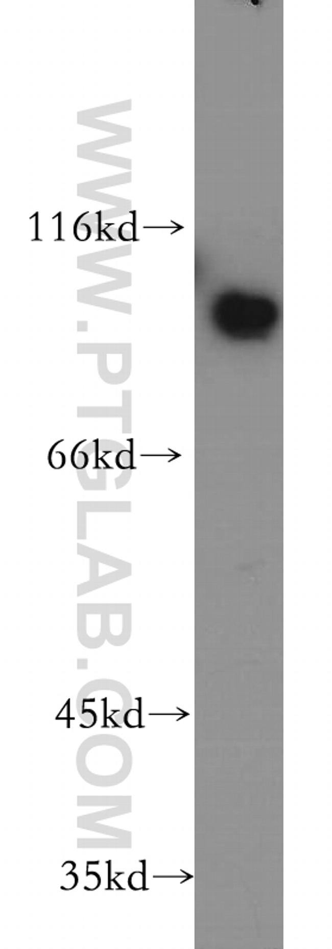 CD39/ENTPD1 Antibody in Western Blot (WB)