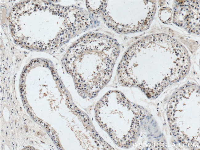 ATN1 Antibody in Immunohistochemistry (Paraffin) (IHC (P))