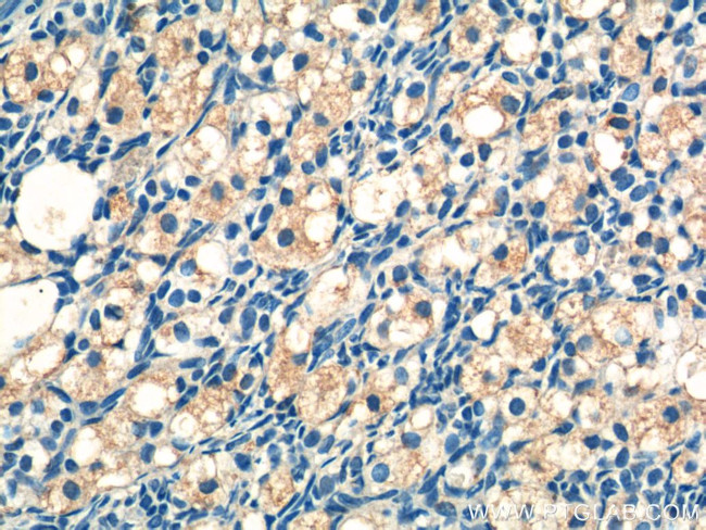 ATN1 Antibody in Immunohistochemistry (Paraffin) (IHC (P))