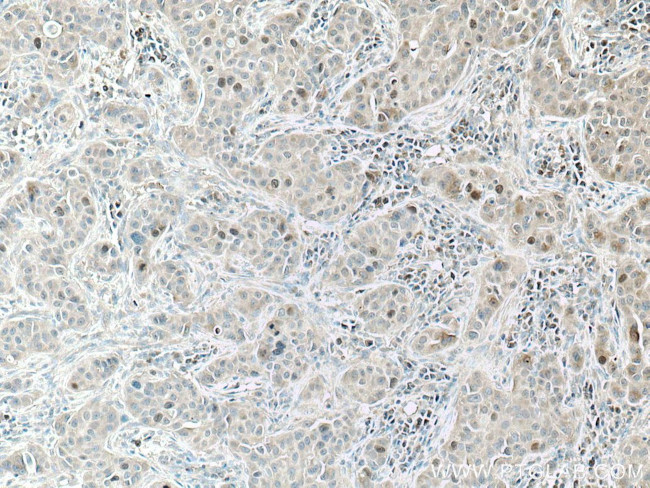 KIF18A Antibody in Immunohistochemistry (Paraffin) (IHC (P))