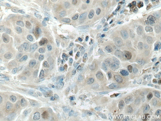 KIF18A Antibody in Immunohistochemistry (Paraffin) (IHC (P))