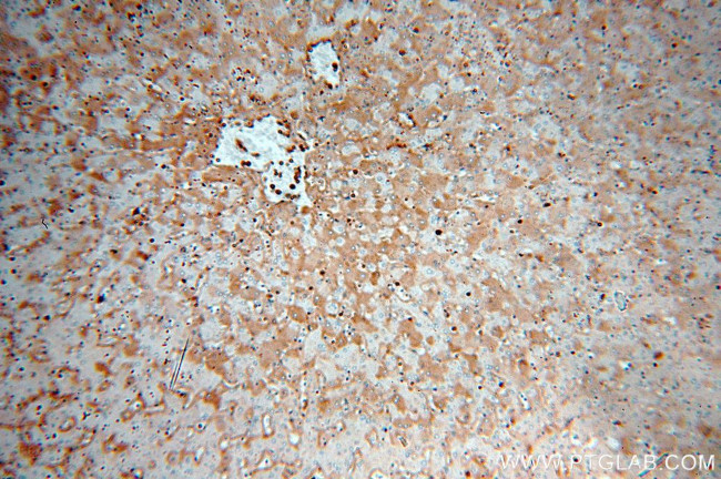 KIF18A Antibody in Immunohistochemistry (Paraffin) (IHC (P))